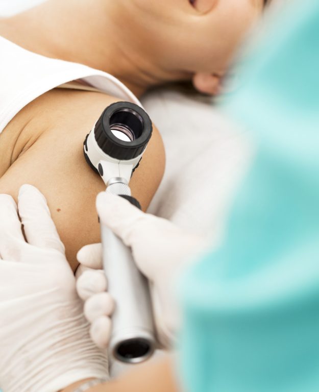 Doctor examining melanoma with dermoscope, copy space